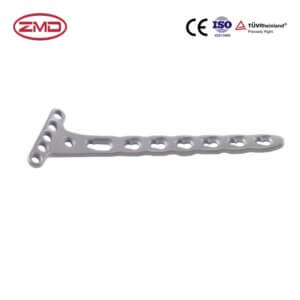 Radius Distal Palm Locking Plate II