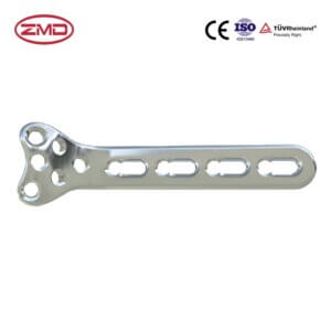 Radius Proximal Locking Plate