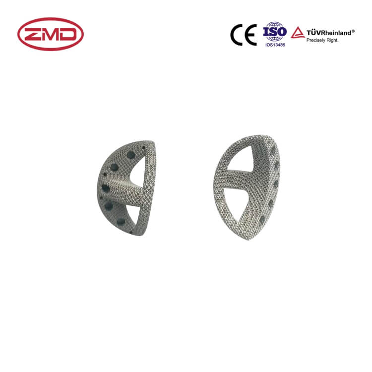 Audment SEE® Trabecular Acetabular Augment (Quarter) - Pharmaceutical Company