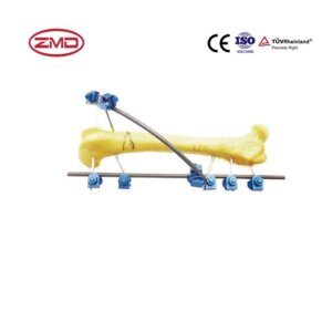 Modular External Fixator