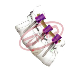 PEEK Spinal Internal Fixation Rod