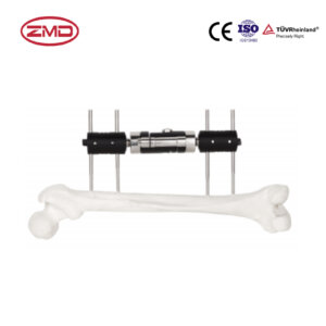 Micro-Dynamic Straight External Fixation for Femur