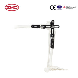 Knee Joint External Fixator