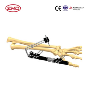 Dynamic Wrist Fixator for Multi-segment