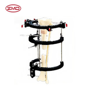 Lower Limb Ring-Shaped Elongation Fixator
