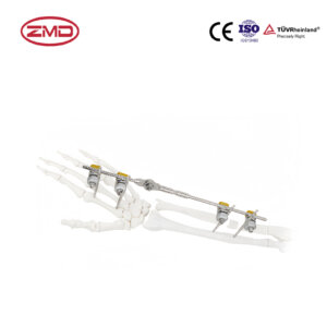 Combined Wrist Joint External Fixator