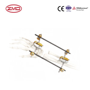 Combined Wrist Joint External Fixator