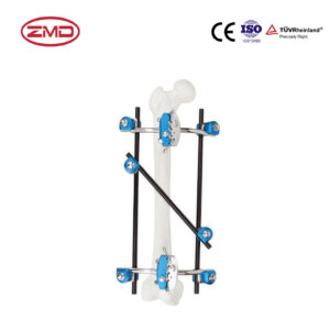 Combined Femoral External Fixator (Semi-Circular Shape)