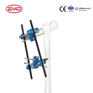 Combined Femoral Proximal External Fixator