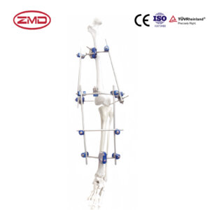 Combined Knee Joint External Fixator