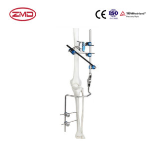 Combined Knee Joint External Fixator