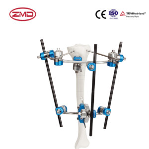 Combined Tibial Proximal External Fixator