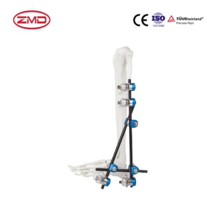 Combined Ankle Joint External Fixator