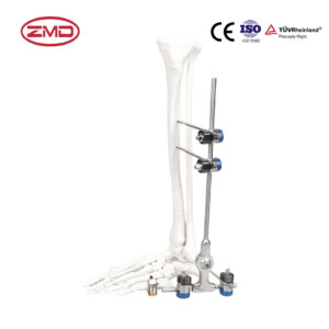 Combined Ankle Joint External Fixator