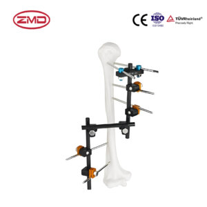 Combined Neighbor Joint Z-type External Fixator (T-type)