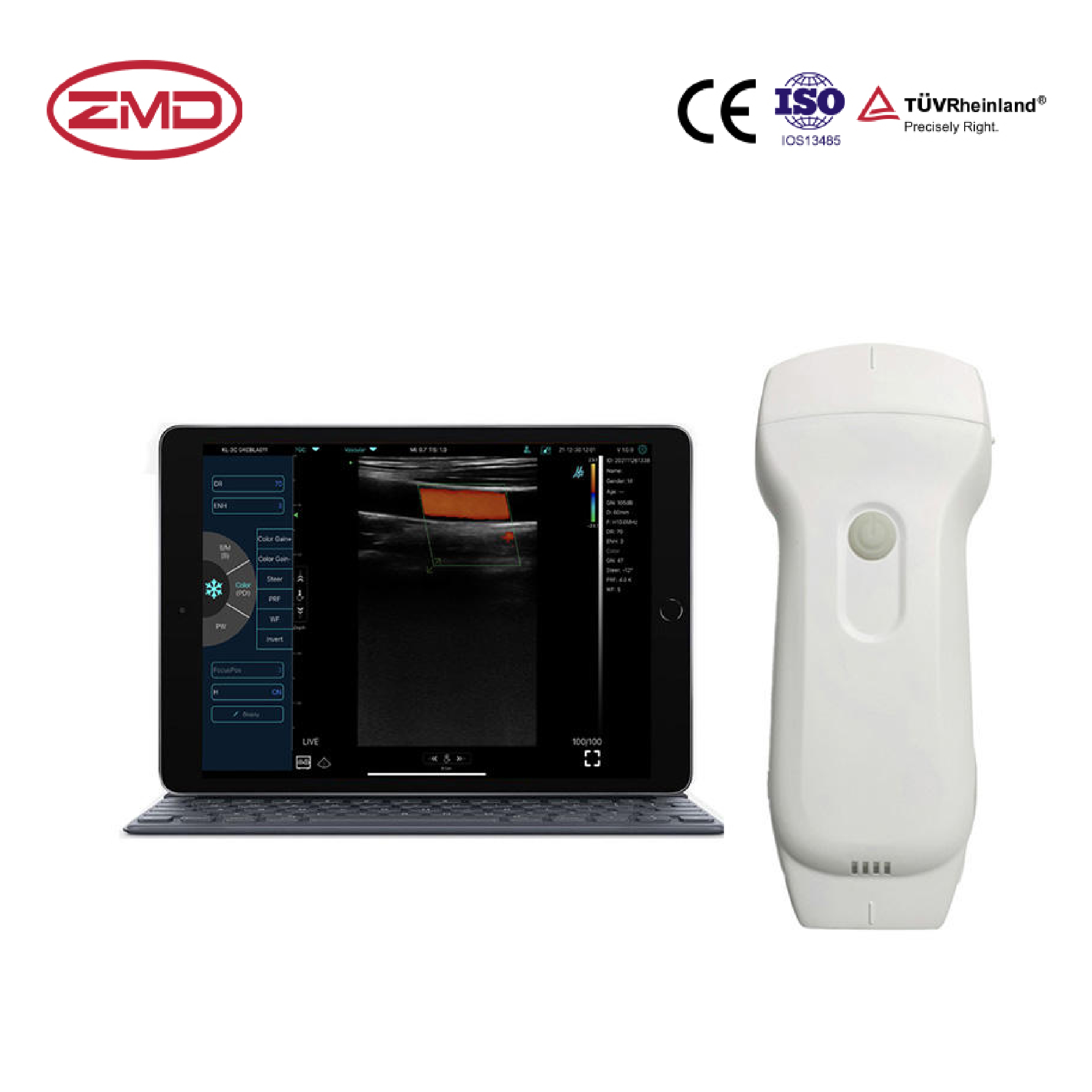 Handheld Ultrasound Scanner - Pharmaceutical Company