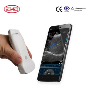 Handheld Ultrasound Scanner