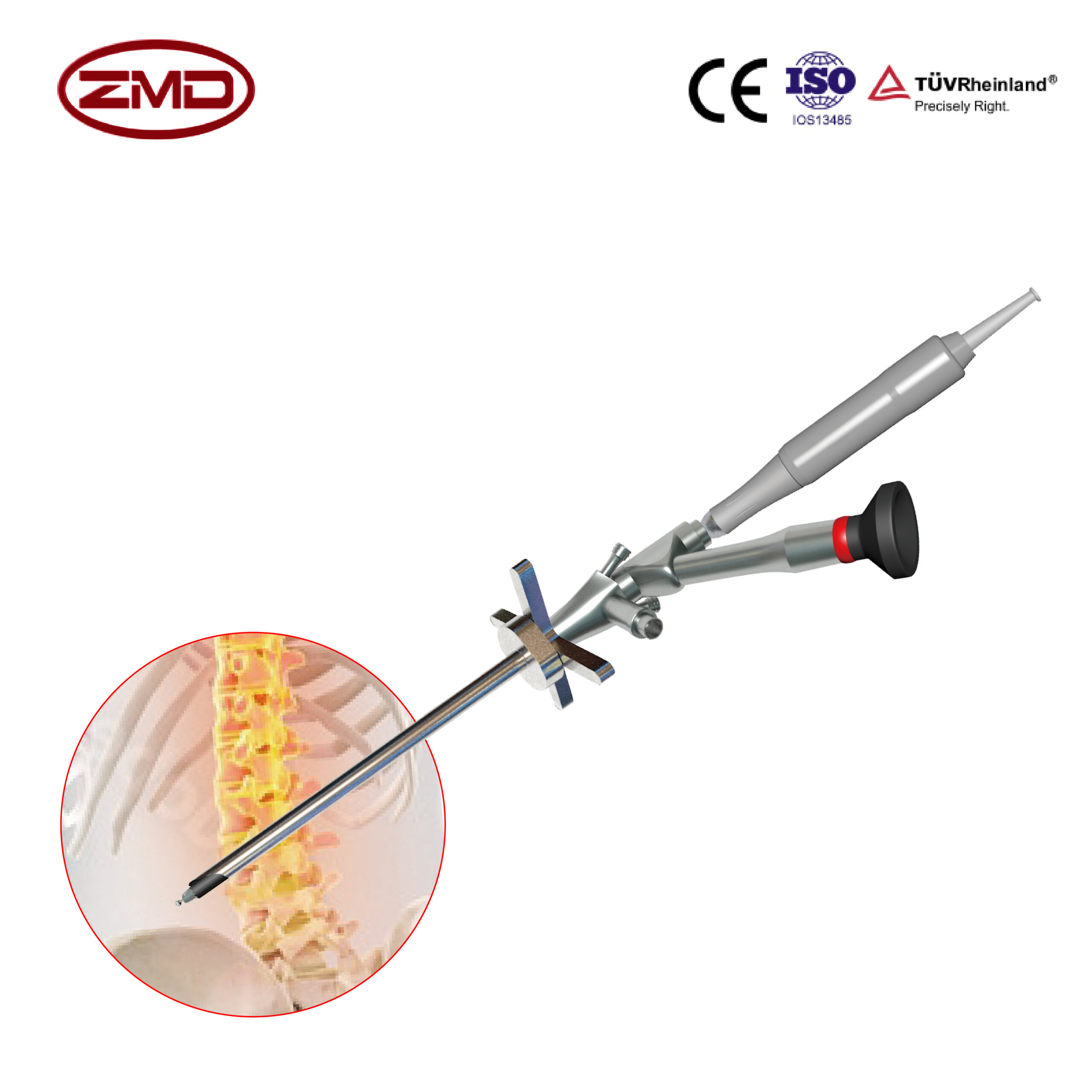 Percutaneous Endoscopic Lumbar Discectomy - Pharmaceutical Company