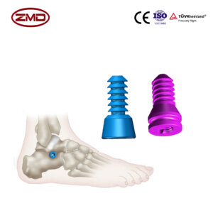 Subtalar Joint Stabilization Screw